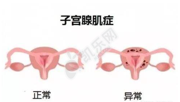 杭州单身男做试管,雌二醇2000试管婴儿移植